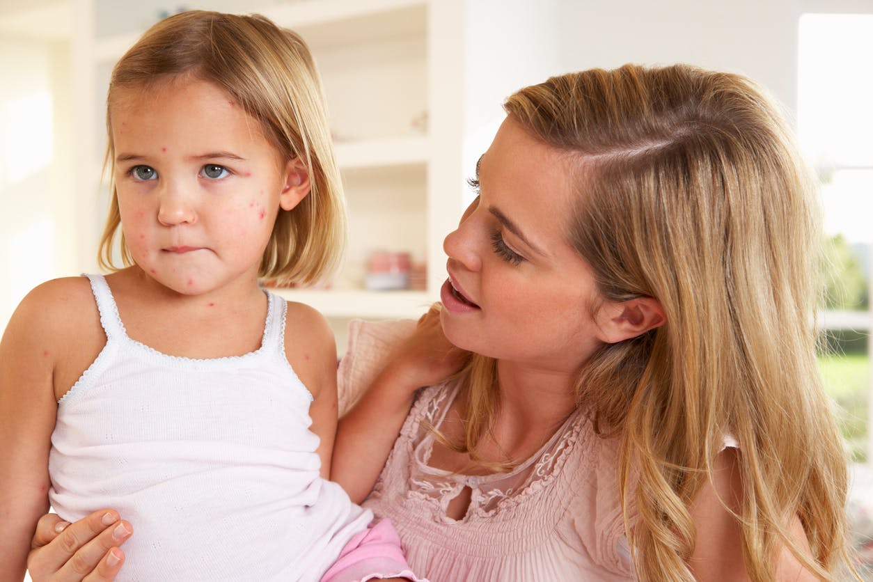 Pourquoi la rougeole, cette maladie contagieuse en recrudescence, n'est pas anodine ?