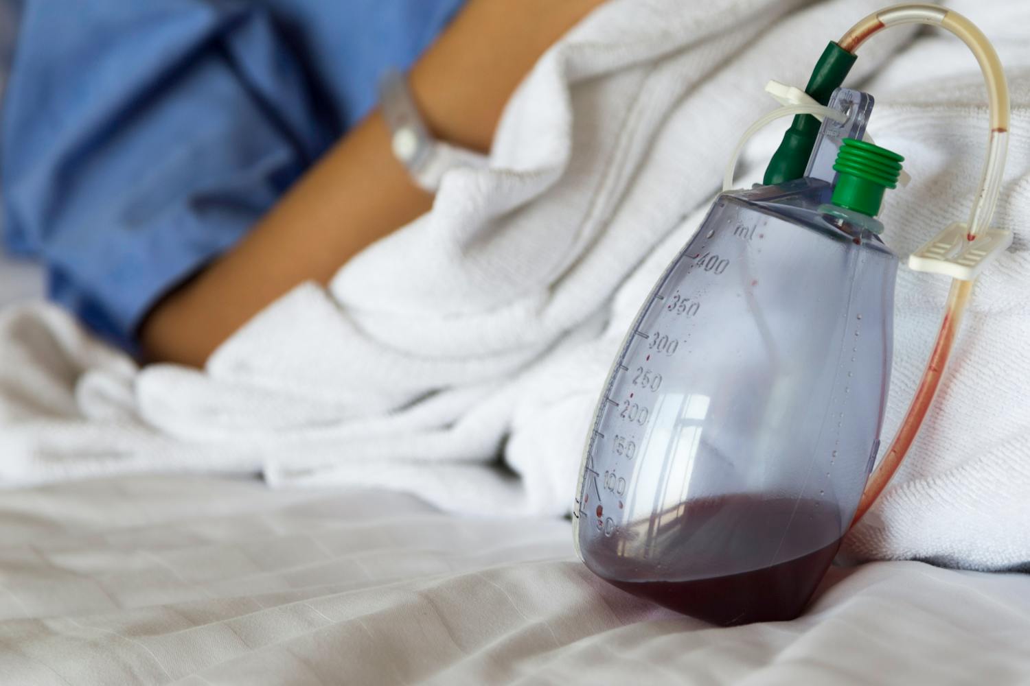 Pourquoi pose-t-on un drain de Redon après une opération ?